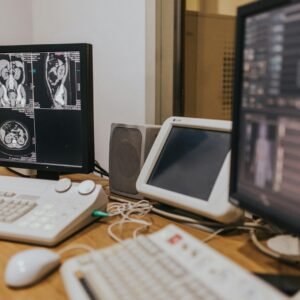 Medical imaging setup with MRI scans on multiple screens in a healthcare facility.